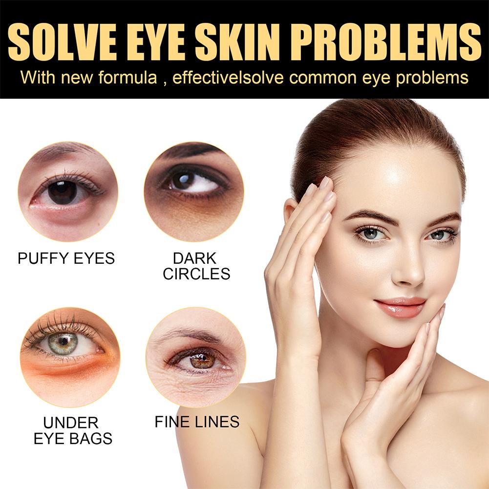 Eye Bags Removal Cream | Last Sale Alert❗️