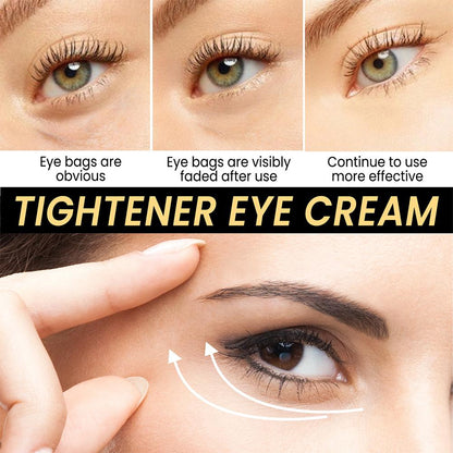 Eye Bags Removal Cream | Last Sale Alert❗️